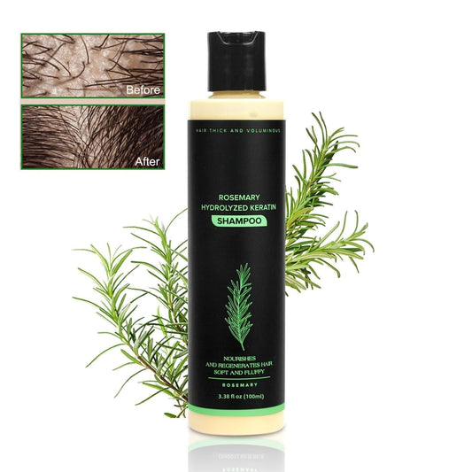 ❤️🌹Early Valentine Sale 70% off🌹❤️ - Organic Rosemary Hair Growth Shampoo