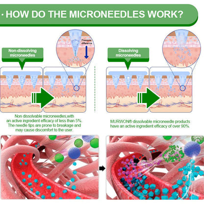 ¡7 días para la transformación! 🥦𝑴𝙐𝗥𝓦𝐎𝙉® 𝑩𝒆𝒓𝑏𝘦𝘳𝑖𝗇𝒆 10-𝗶𝙣-𝟏 𝑁𝑎𝑛𝑜 𝘔𝘪𝘤𝘳𝘰𝘯𝘦𝘦𝘥𝘭𝘦 𝖯𝚊𝗍𝖼𝗁 |𝘉𝘢𝘤𝘬𝘦𝘥 𝘣𝘺 𝘴𝘶𝘴𝘵𝘦𝘯𝘵𝘦 | 10-𝗂𝗇-𝟣 𝖿𝗈𝗋𝗆𝗎𝗅𝖺 | 𝑅𝑒𝑠𝑢𝑙𝑡𝑠 𝑖𝑛 7 𝑑𝑎𝑦𝑠 