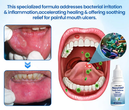 Suero protector dental LBMLBM™ NanoHAP 