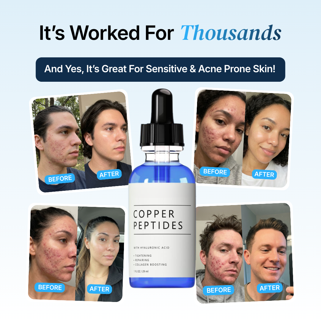 2 Bottles GHK-Cu for Free