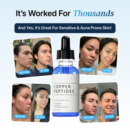 2 Bottles GHK-Cu for Free